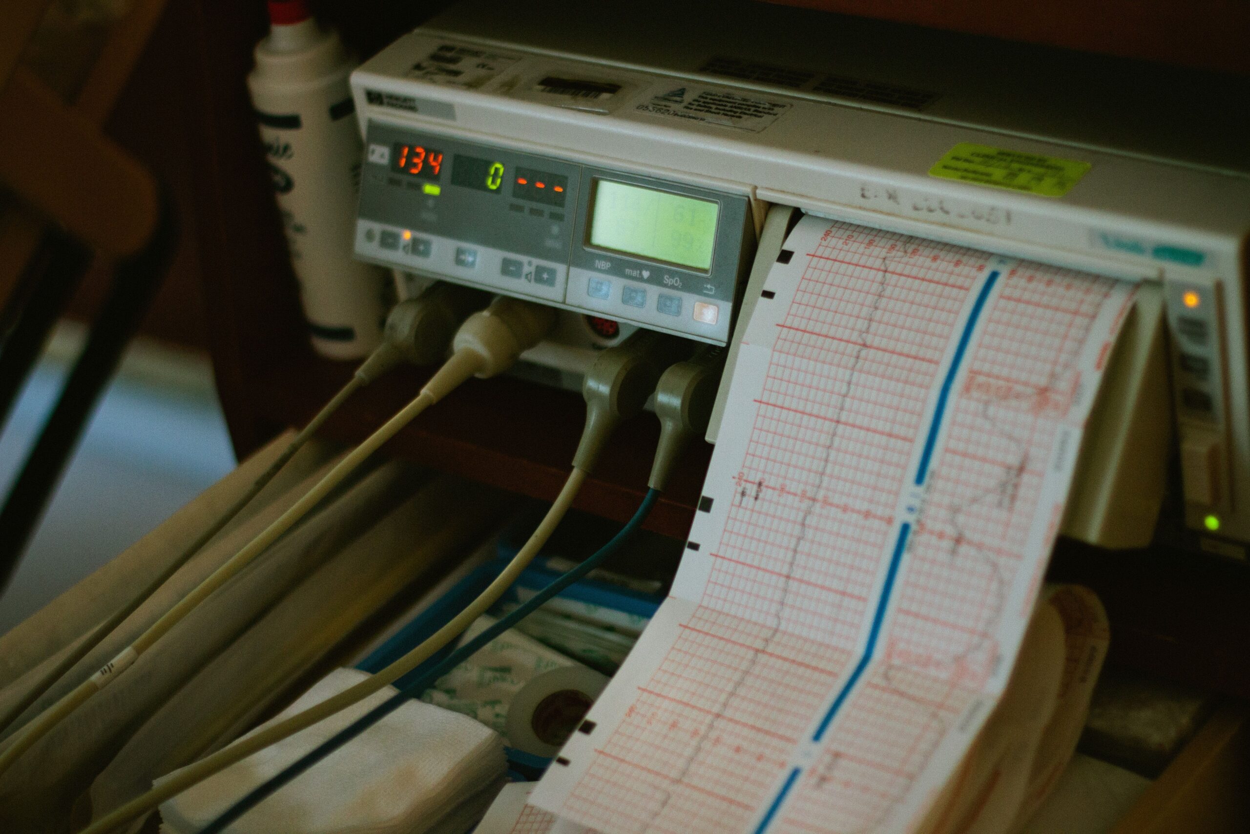 Heart stress testing key to diagnosing cardiac conditions